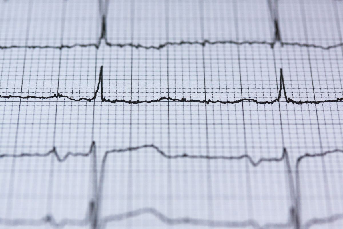 NestJS Health Check Failing on Render — What's Actually Different
